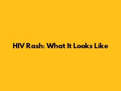 HIV Rash: What It Looks Like