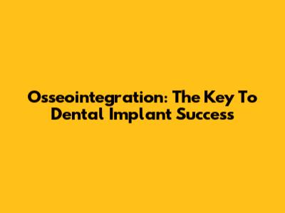 Osseointegration: The Key To Dental Implant Success