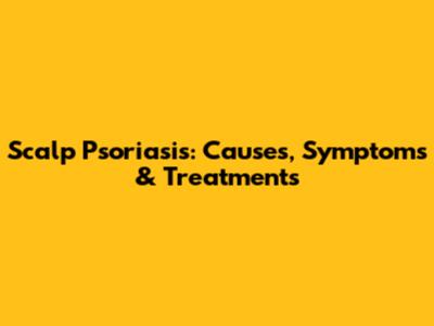 Scalp Psoriasis: Causes, Symptoms & Treatments