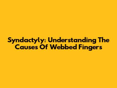 Syndactyly: Understanding The Causes Of Webbed Fingers