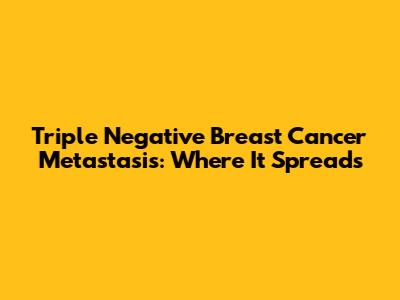 Triple Negative Breast Cancer Metastasis: Where It Spreads