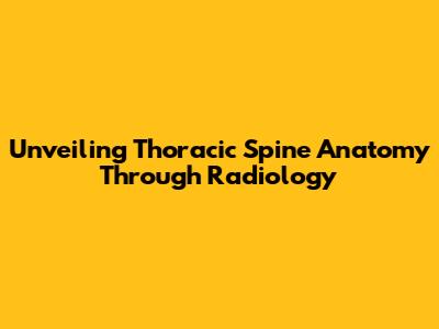 Unveiling Thoracic Spine Anatomy Through Radiology
